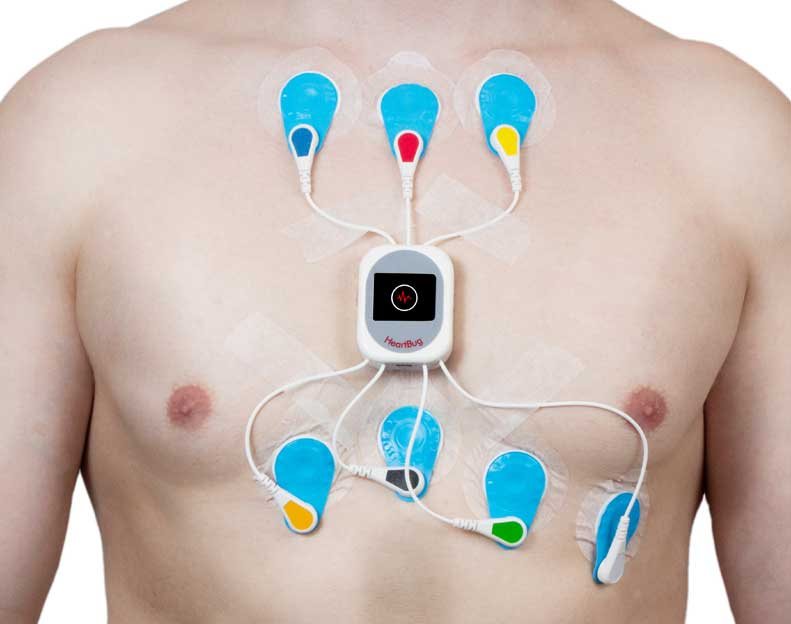 Holter 7 Dias